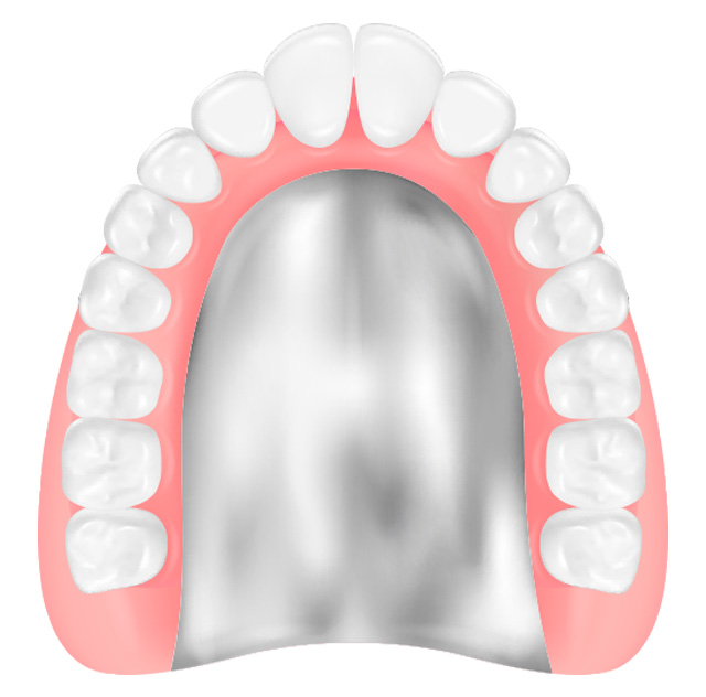 コバルトクロム床義歯